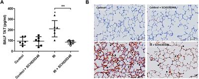 Protease-Activated Receptor-1 Antagonist Protects Against Lung Ischemia/Reperfusion Injury